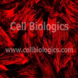 Human Hypertension Smooth Muscle Cells (7)